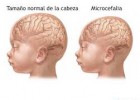 adn-dna: 322- Creado un prototipo de cerebro humano con células madre | Recurso educativo 420786