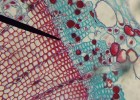 Phloem vs Xylem - Difference and Comparison | Diffen | Recurso educativo 725536